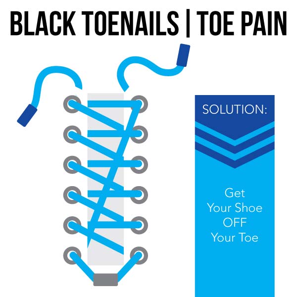 Lacing technique for black toenails