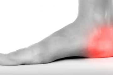 painful inflamed heel pain