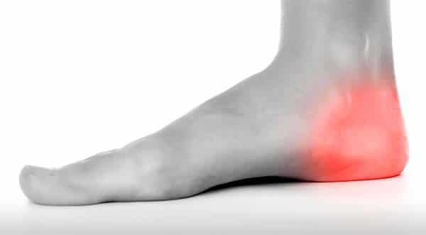 painful inflamed heel pain