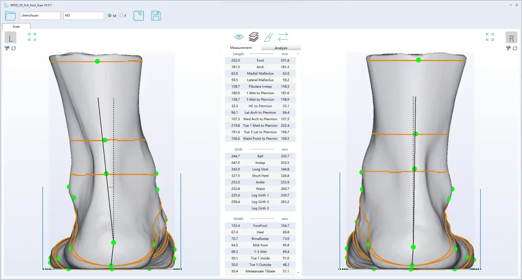 3D foot scan showing detailed measurements used to design custom orthotics