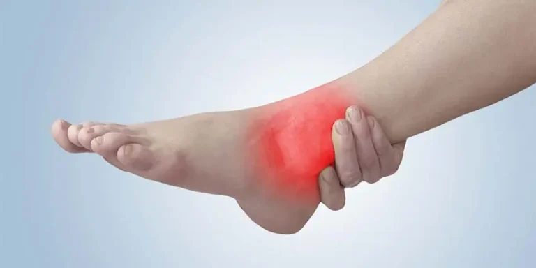 Ankle pain — foot injury Foot showing red highlighted area indicating ankle pain or injury