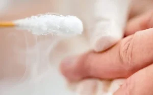 Cryotherapy treatment applying liquid nitrogen to a plantar wart