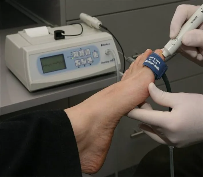 Handheld Doppler ultrasound being used to check circulation in a diabetic patient's foot